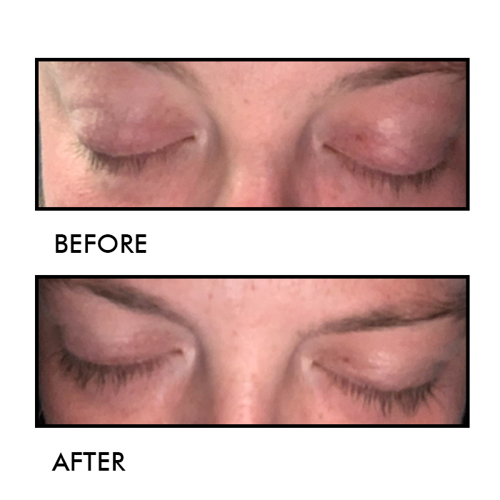 Eyelash Enhancing Serum
