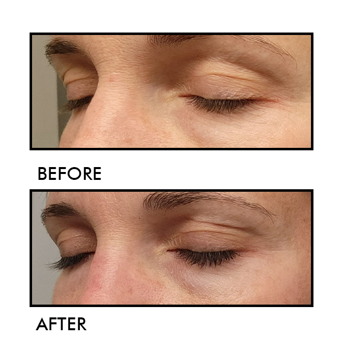 Eyelash Enhancing Serum