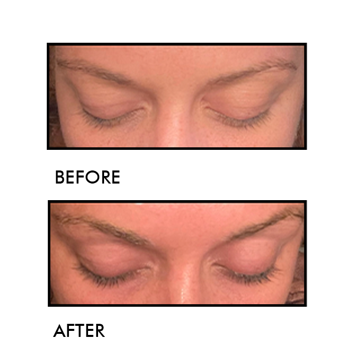 Eyelash Enhancing Serum
