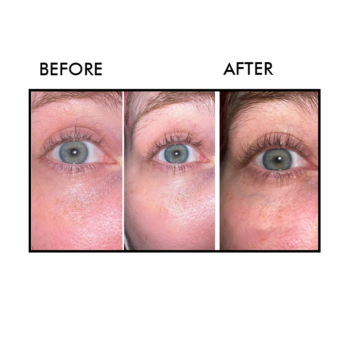 Eyelash Enhancing Serum
